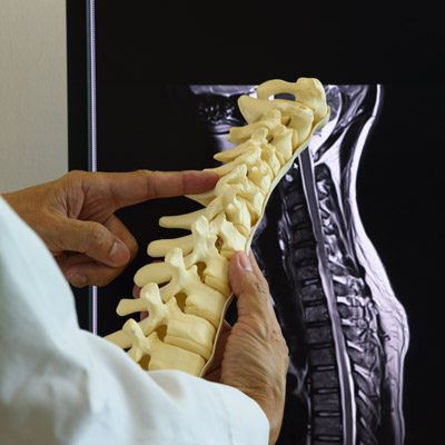 Chiropractic X-Ray: Why Imaging Matters in Modern Chiropractic Care