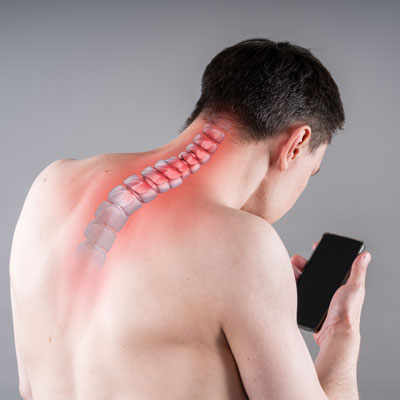 text neck syndrome